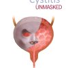 Cystitis unmasked