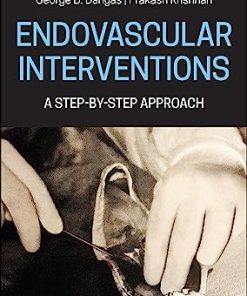 Endovascular Interventions: A Step-by-Step Approach