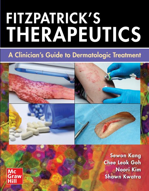 Fitzpatrick’s Therapeutics: A Clinician’s Guide to Dermatologic Treatment