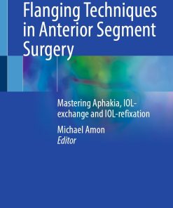 Flanging Techniques in Anterior Segment Surgery