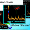 Mastering Doppler Principles and Hemodynamics- AllAboutUltrasound