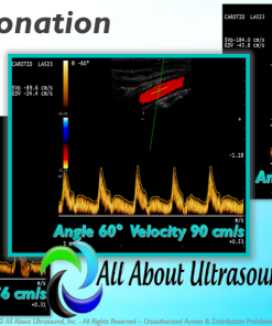 Mastering Doppler Principles and Hemodynamics- AllAboutUltrasound