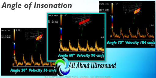 Mastering Doppler Principles and Hemodynamics- AllAboutUltrasound