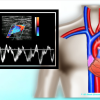 Mastering Upper Extremity Duplex – AllAboutUltrasound