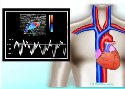 Mastering Upper Extremity Duplex – AllAboutUltrasound