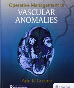 Operative Management of Vascular Anomalies ()