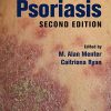 Psoriasis, Second Edition