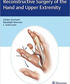 Reconstructive Surgery of the Hand and Upper Extremity