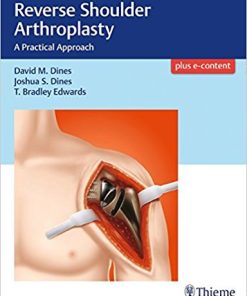 Reverse Shoulder Arthroplasty: A Practical Approach ()