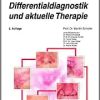 Rosazea – Klinik, Differentialdiagnostik und aktuelle Therapie (UNI-MED Science), 2nd Edition