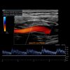 Society for Vascular Medicine Comprehensive Review of Vascular Ultrasound Interpretation and Registry Preparation 2023