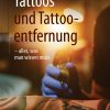 Tattoos und Tattooentfernung