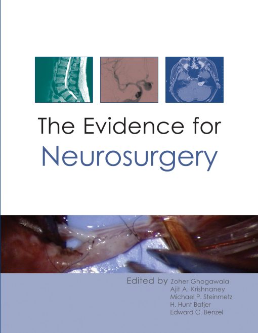 The Evidence for Neurosurgery ()