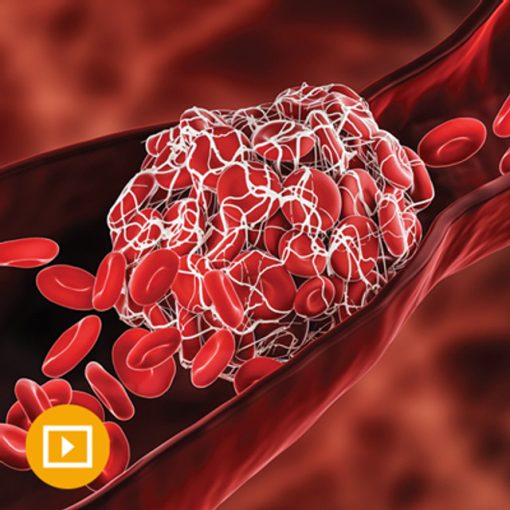 Thrombosis & Thromboembolism 2022