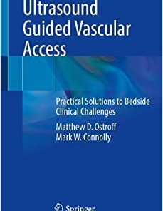 Ultrasound Guided Vascular Access: Practical Solutions to Bedside Clinical Challenges