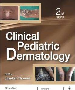 Clinical Pediatric Dermatology