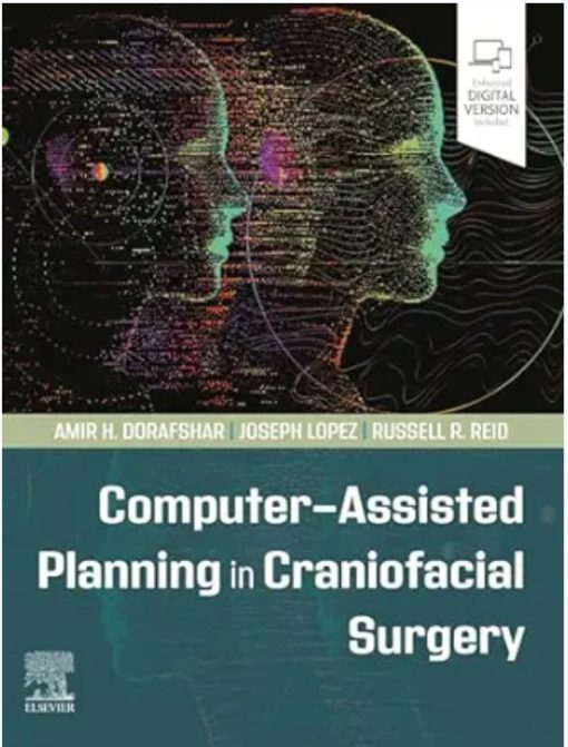 Computer-Assisted Planning in Craniofacial Surgery (ePub+Converted PDF+Videos)