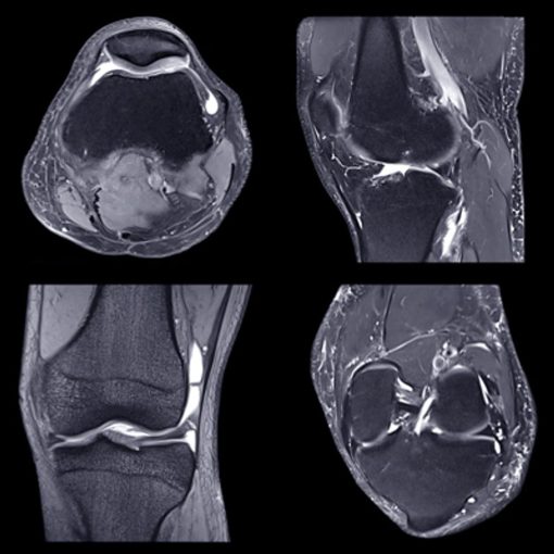 NYU Langone Advanced Imaging Of The Musculoskeletal System: Up Your Game 2023 (Videos)