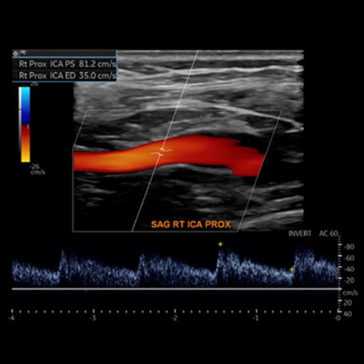 Society For Vascular Medicine Comprehensive Review Of Vascular Ultrasound Interpretation And Registry Preparation 2023 (Videos)