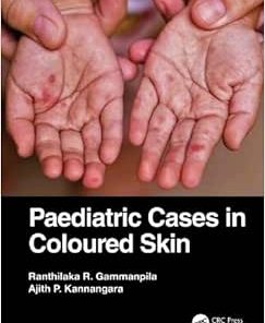 Paediatric Cases in Coloured Skin