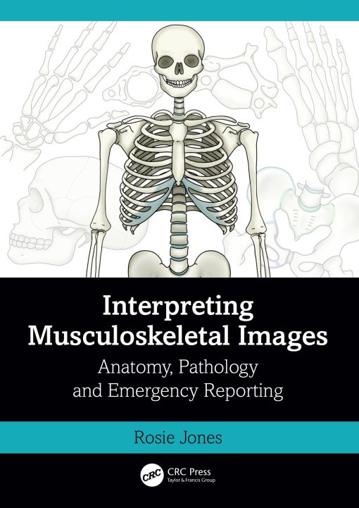 Interpreting Musculoskeletal Images (EPUB)