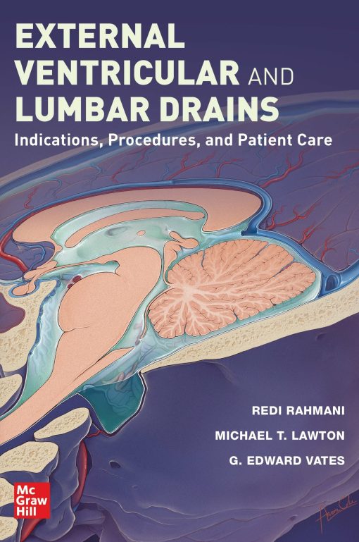 External Ventricular And Lumbar Drains: Indications, Procedures, And Patient Care (EPUB)