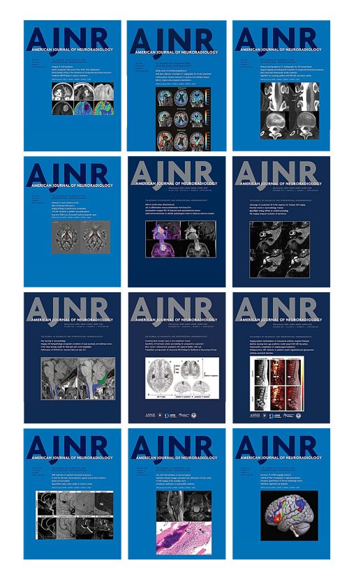 American journal of Neuroradiology 2023 Full Archives (True PDF)