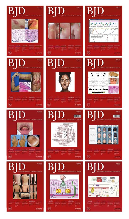 British Journal of Dermatology