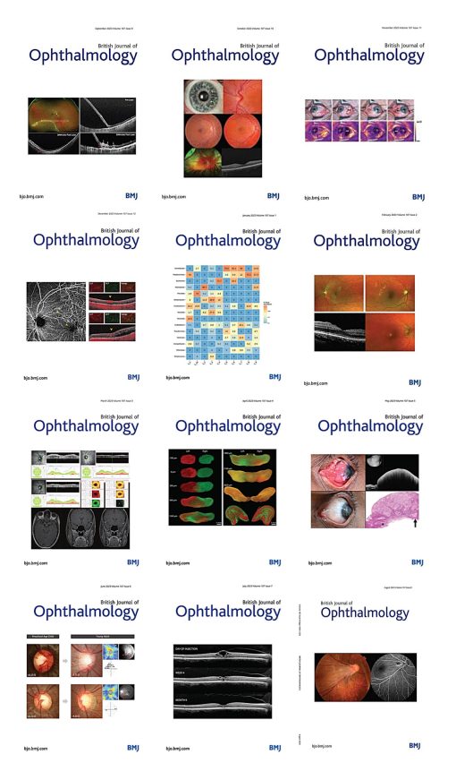 British Journal of Ophthalmology 2023 Full Archives (True PDF)