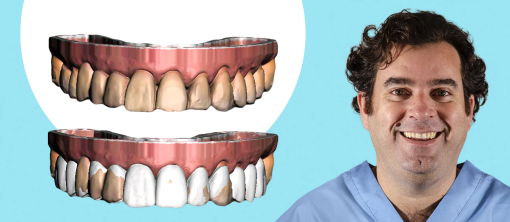 OHI-S The Complete Guide To Digital Dentistry (Videos)