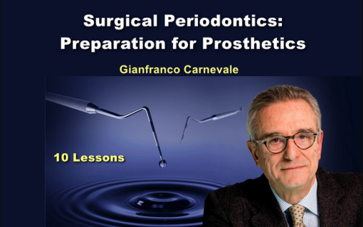 OHI-S Surgical Periodontics: Preparation For Prosthetics (Videos)