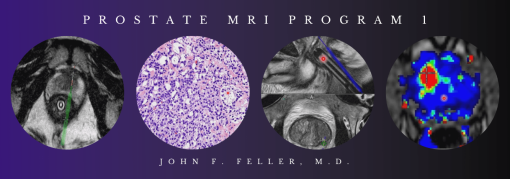 2021 Prostate MRI (Program 1) – John F. Feller, M.D (Videos)