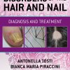 Disorders of the Hair and Nail