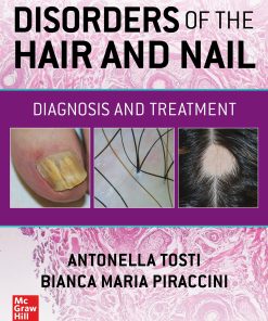 Disorders of the Hair and Nail