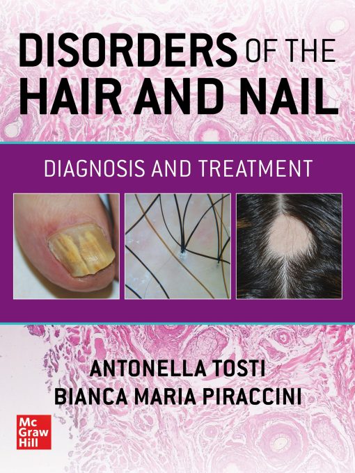 Disorders of the Hair and Nail