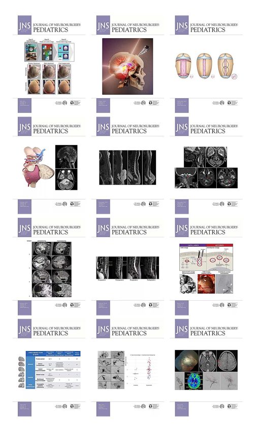 Journal Of Neurosurgery Pediatrics 2023 Full Archives (True PDF)