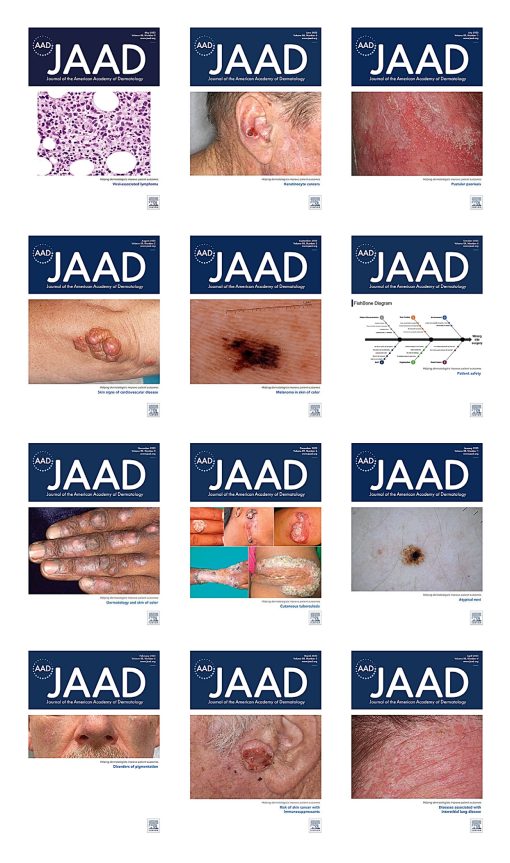 Journal of the American Academy of Dermatology