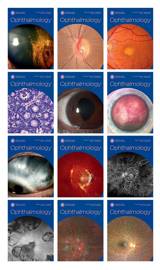 Ophthalmology 2023 Full Archives (True PDF)