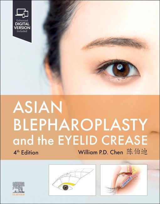 Asian Blepharoplasty And The Eyelid Crease, 4th Edition (True PDF)