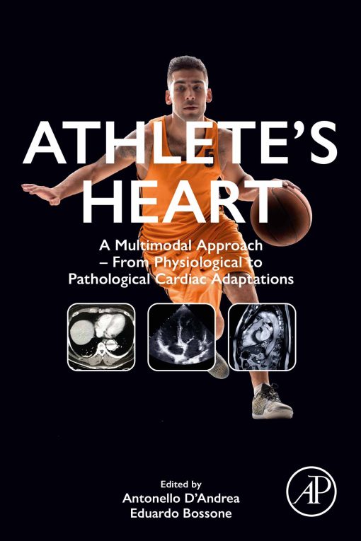 Athlete’s Heart: A Multimodal Approach – From Physiological To Pathological Cardiac Adaptations (Original PDF From Publisher)