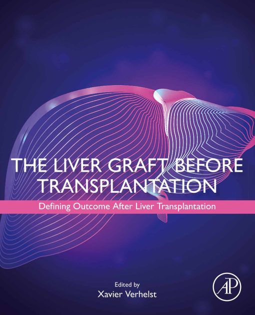 The Liver Graft Before Transplantation: Defining Outcome After Liver Transplantation (Original PDF From Publisher)