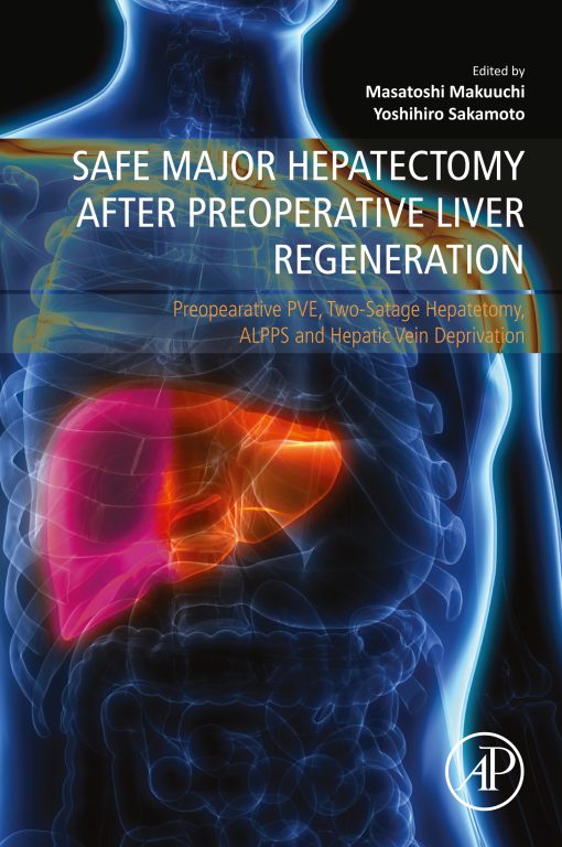 Safe Major Hepatectomy After Preoperative Liver Regeneration: Preopearative PVE, Two-Satage Hepatetomy, ALPPS And Hepatic Vein Deprivation (Original PDF From Publisher)