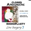 2022 Closed Atraumatic Rhinoplasty and FaceLift&NeckLift Course 7