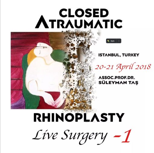 Closed Atraumatic Rhinoplasty