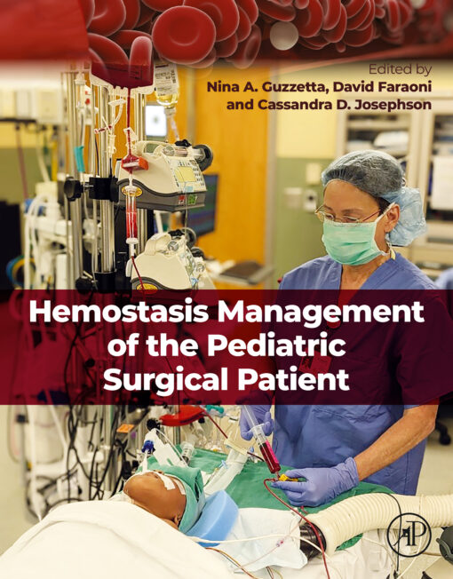 Hemostasis Management of the Pediatric Surgical Patient (Original PDF from Publisher)