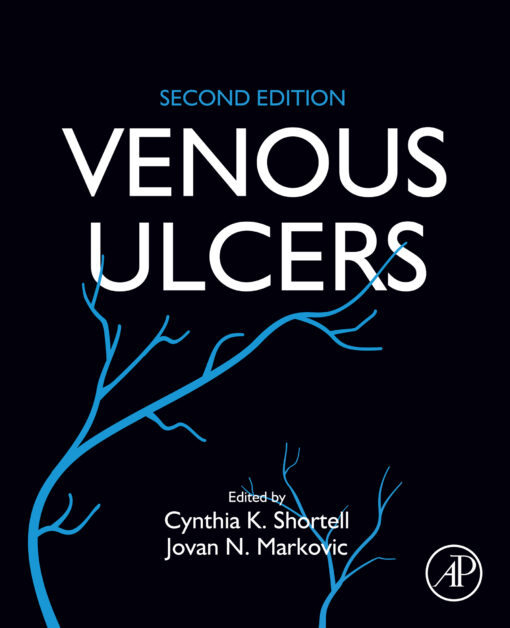 Venous Ulcers, 2nd Edition (EPUB)