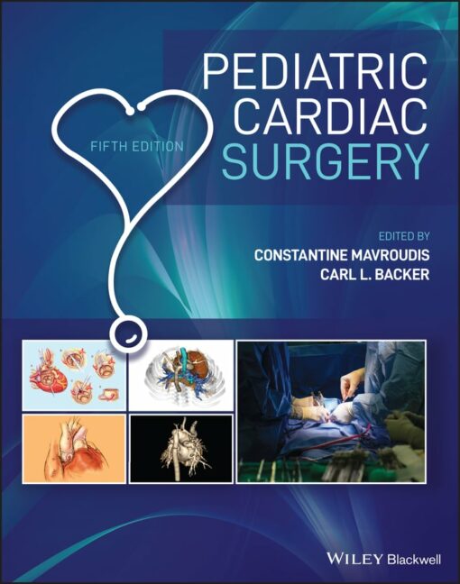 Pediatric Cardiac Surgery, 5th Edition (EPUB)