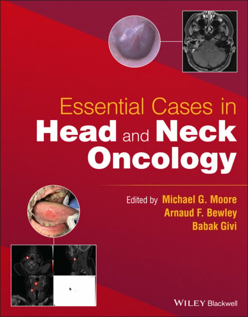 Essential Cases in Head and Neck Oncology (EPUB)