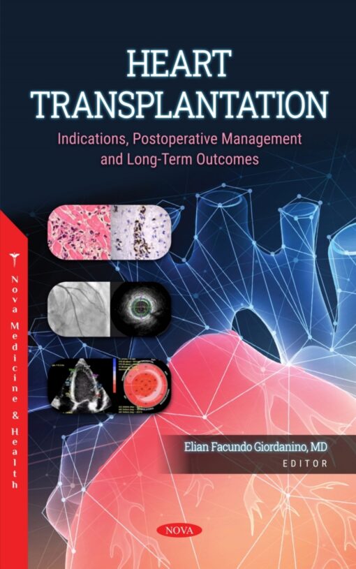 Heart Transplantation: Indications, Postoperative Management and Long-Term Outcomes (Original PDF from Publisher)