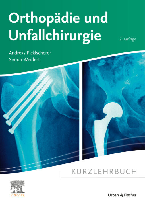 Kurzlehrbuch Orthopädie und Unfallchirurgie, 2nd Edition (Original PDF from Publisher)